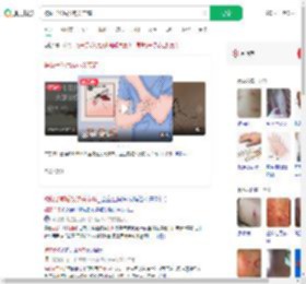 被蚊子咬后发热关节痛_360搜索